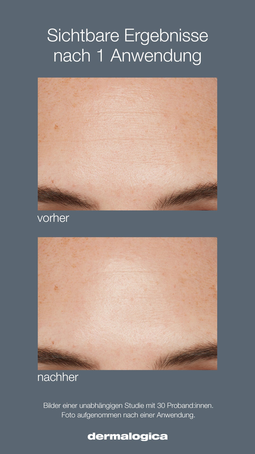 Liquid Peelfoliant
